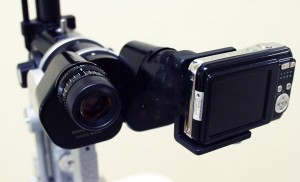 Slit Lamp Camera Adapter