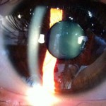 iPhone Eye Picture
