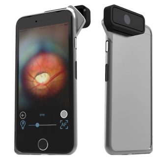 D-Eye Portable Ophthalmoscope