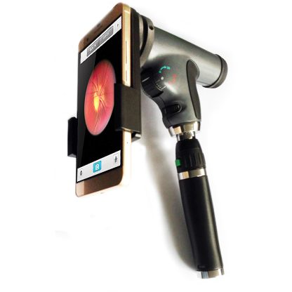 Panoptic Ophthalmoscope Smartphone Adapter