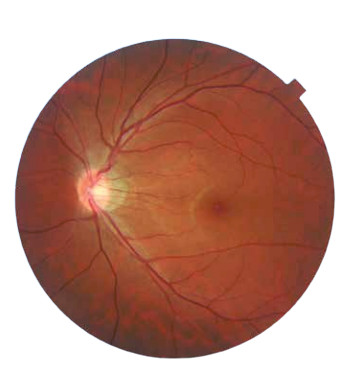 Topcon NW8 with Windows 10 computer - Refurbished 5 Captura de Pantalla 2026 04 20 a las 2.25.38 p. m