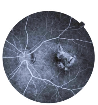 Topcon NW8 with Windows 10 computer - Refurbished 6 Captura de Pantalla 2026 04 20 a las 2.25.55 p. m