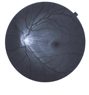 Topcon NW8 with Windows 10 computer - Refurbished 7 Captura de Pantalla 2026 04 20 a las 2.26.03 p. m
