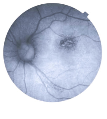 Topcon NW8 with Windows 10 computer - Refurbished 8 Captura de Pantalla 2026 04 20 a las 2.26.11 p. m