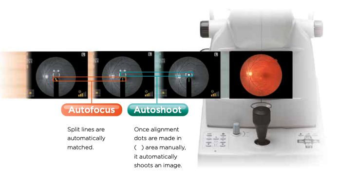 Topcon NW8 with Windows 10 computer - Refurbished 13 Captura de Pantalla 2026 04 20 a las 2.39.57 p. m