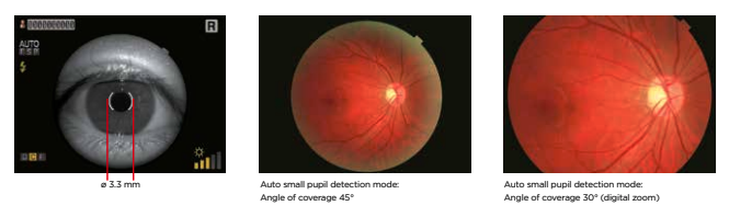 Topcon NW8 with Windows 10 computer - Refurbished 14 Captura de Pantalla 2026 04 20 a las 2.41.39 p. m