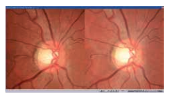 Topcon NW8 with Windows 10 computer - Refurbished 18 Captura de Pantalla 2026 04 20 a las 2.48.33 p. m