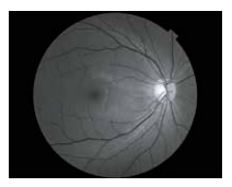 Topcon NW8 with Windows 10 computer - Refurbished 19 Captura de Pantalla 2026 04 20 a las 2.49.39 p. m