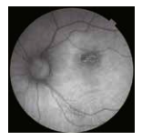 Topcon NW8 with Windows 10 computer - Refurbished 22 Captura de Pantalla 2026 04 20 a las 2.53.30 p. m