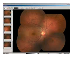 Topcon NW8 with Windows 10 computer - Refurbished 24 Captura de Pantalla 2026 04 20 a las 2.54.39 p. m