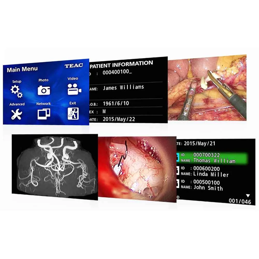 Teac UR-4MD Medical Video Recorder | Digital Eye Center