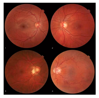 Topcon NW-400 with Windows 10 computer - Refurbished 6 Captura de Pantalla 2026 04 20 a las 2.04.36 p. m