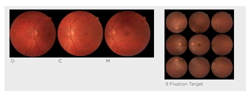 Topcon NW-400 with Windows 10 computer - Refurbished 11 Captura de Pantalla 2026 04 20 a las 2.14.35 p. m