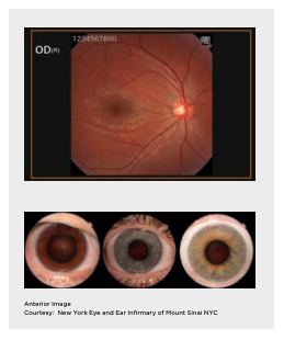 Topcon NW-400 with Windows 10 computer - Refurbished 12 Captura de Pantalla 2026 04 20 a las 2.16.13 p. m