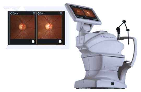 Topcon NW-400 with Windows 10 computer - Refurbished 8 blanc