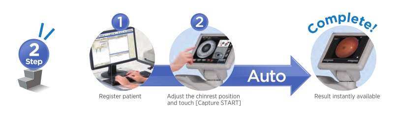 Topcon NW400 Automatic Mode