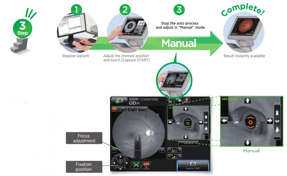 Topcon TRC 400 Fundus Camera