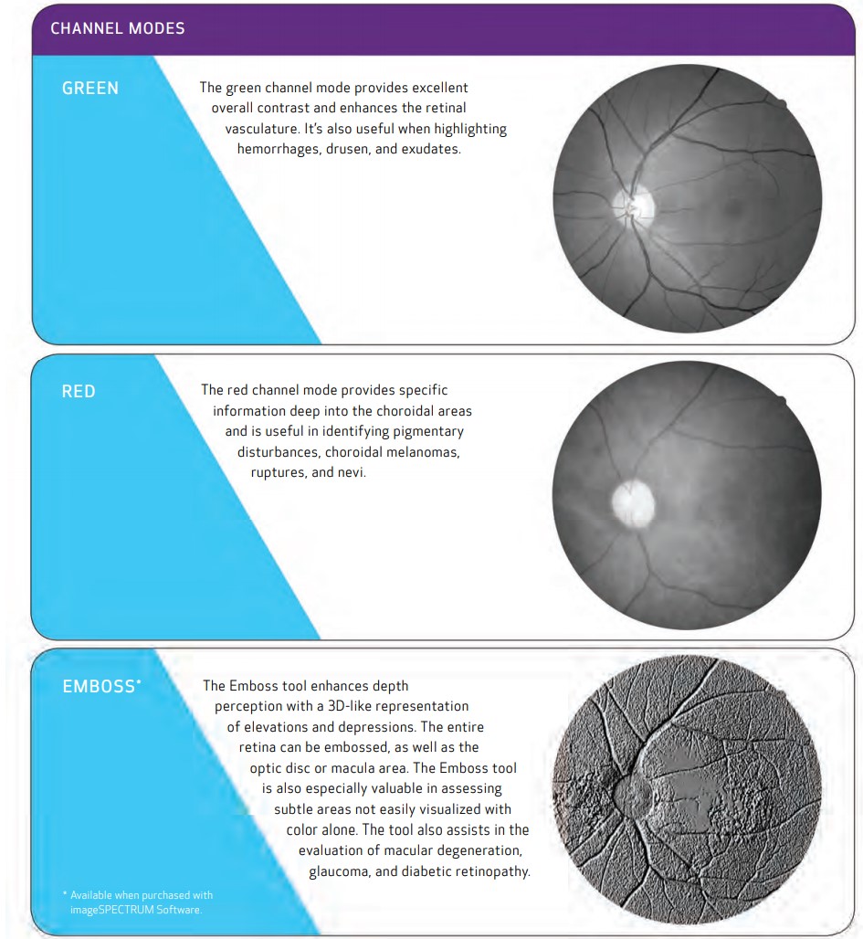 Canon Retinal Camera