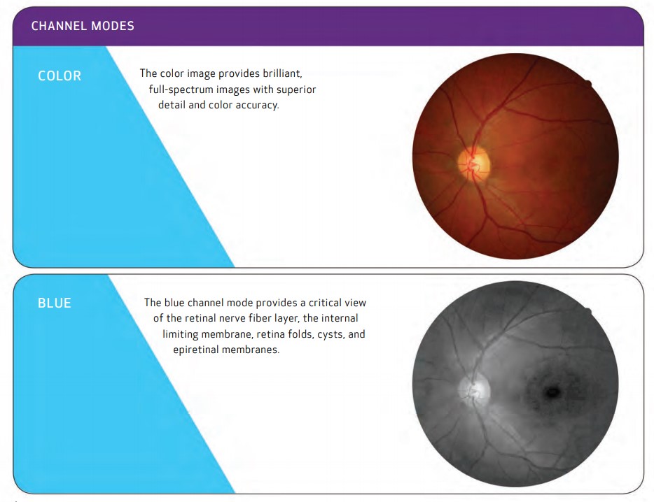 Canon Retinal Camera