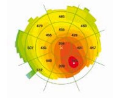 Pachymetry Map