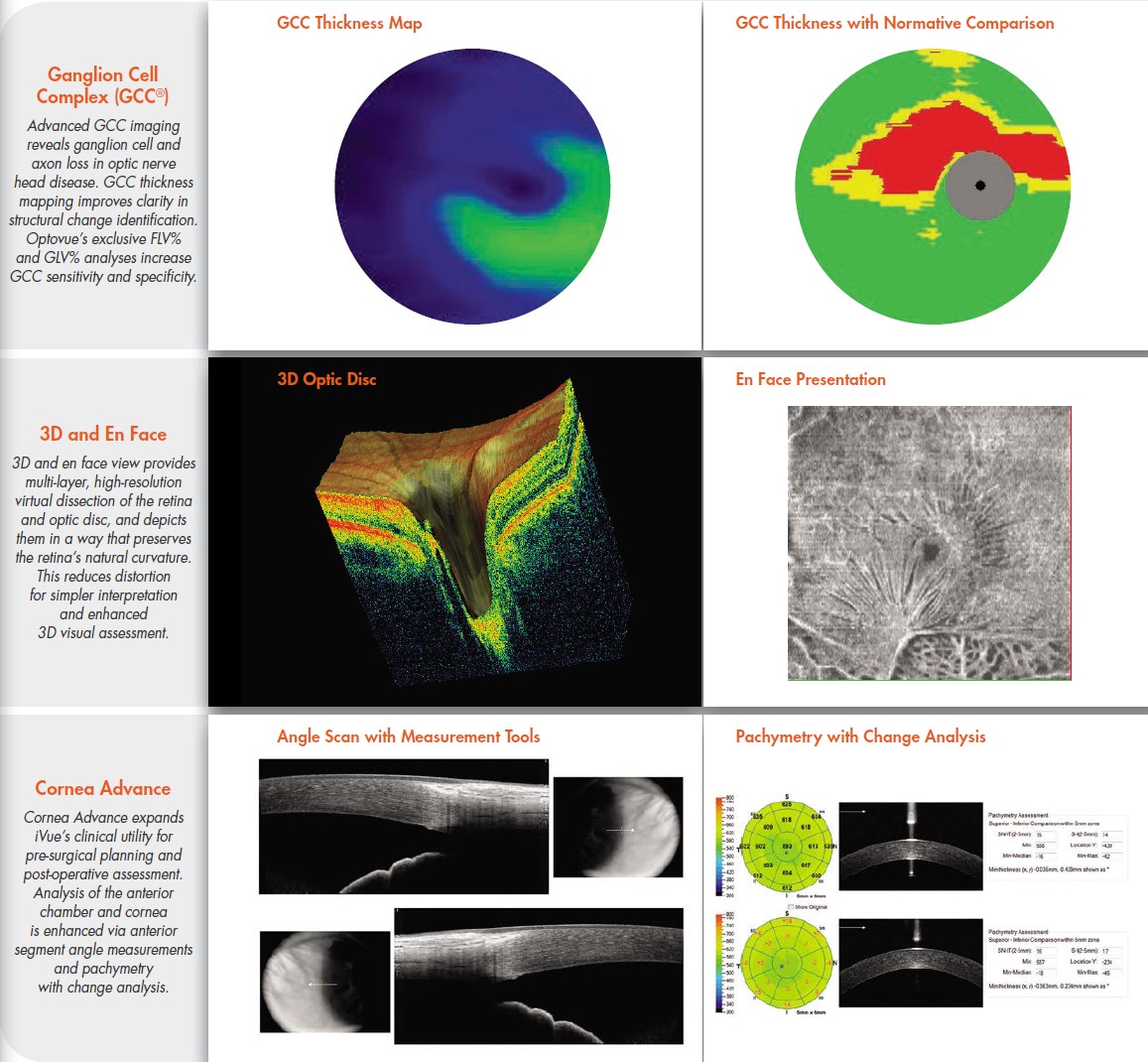 Optovue iVue Advanced Diagnostic