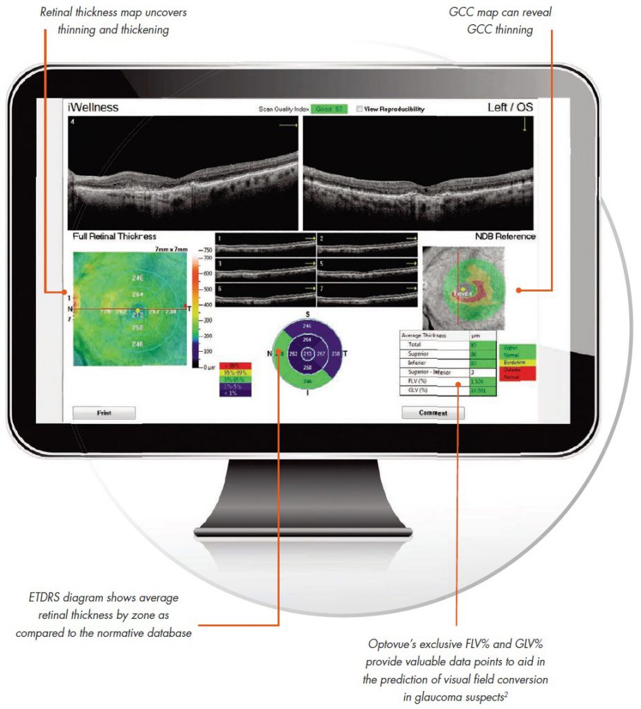 Optovue iVue OCT - Refurbished - Digital Eye Center