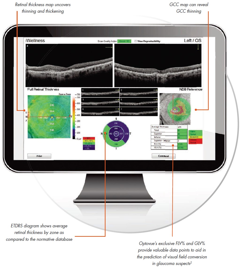 Optovue iWellness Exam