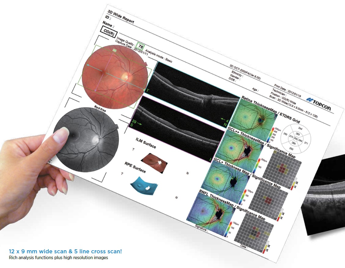 Topcon 3D 2000 OCT