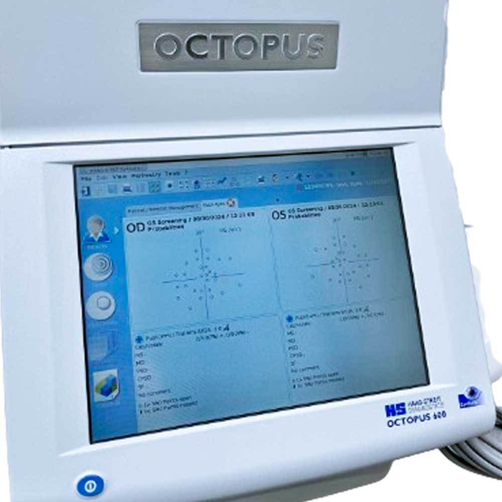 Haag Streit Octopus 600 - Perimeter Visual Field Analyzer - Used 2 Haag-Streit Octopus 600 visual field equipment — EyeSuite OD OS screening probability display