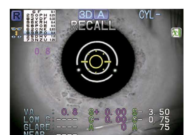 Nidek ARK-1e - Autorefractor Keratometer - Used 9 ARK 1 AR 1E 8P 9 A3 3 2