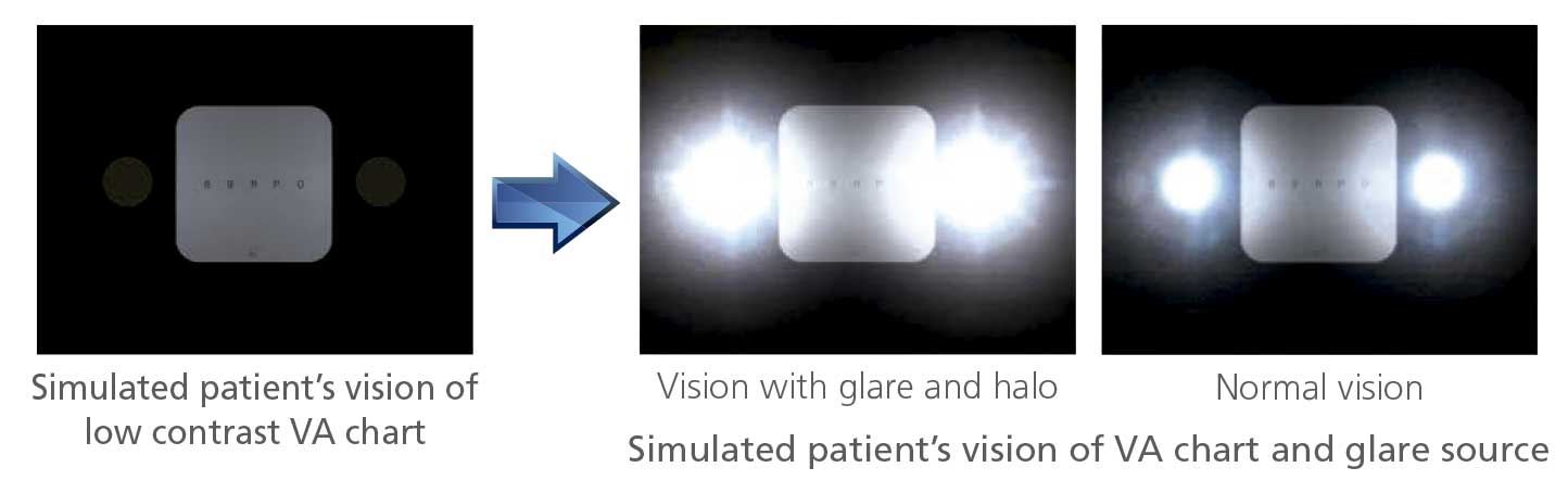 Nidek ARK-1e - Autorefractor Keratometer - Used 11 ARK 1 AR 1E 8P 9 A3 3 3