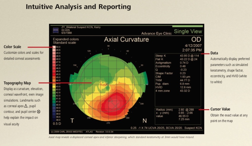 Zeiss Atlas - 9000 - Corneal Topographer Win 10 - Refurbished 21 Atlas 9000 2