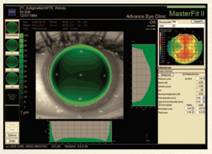 Zeiss Atlas - 9000 - Corneal Topographer Win 10 - Refurbished 24 Atlas 9000 5