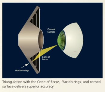 Zeiss Atlas - 9000 - Corneal Topographer Win 10 - Refurbished 18 Atlas 9000
