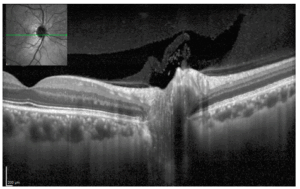 Heidelberg Spectralis OCT - Mode 3 - Refurbished 7 Captura de Pantalla 2025 10 23 a las 3.35.28 p. m