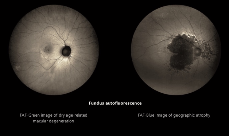 Zeiss Clarus 500 FA - Fundus Camera - Refurbished 11 Clarus 500 3