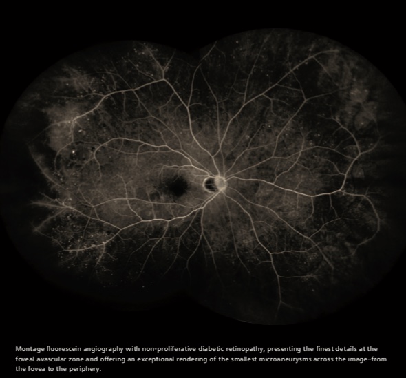 Zeiss Clarus 700 FA, FAF, ICG - Fundus Camera - Refurbished 5 Clarus 700 1