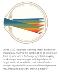 Zeiss Clarus 700 FA, FAF, ICG - Fundus Camera - Refurbished 6 Clarus 700 2