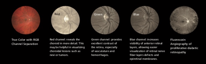 Zeiss Clarus 700 FA, FAF, ICG - Fundus Camera - Refurbished 7 Clarus 700 3