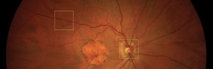 Zeiss Clarus 700 FA, FAF, ICG - Fundus Camera - Refurbished 9 Clarus 700 6