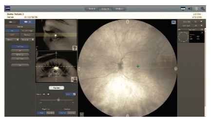 Zeiss Clarus 700 FA, FAF, ICG - Fundus Camera - Refurbished 11 Clarus 700 8