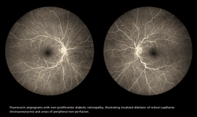 Zeiss Clarus 700 FA, FAF, ICG - Fundus Camera - Refurbished 4 Clarus 700