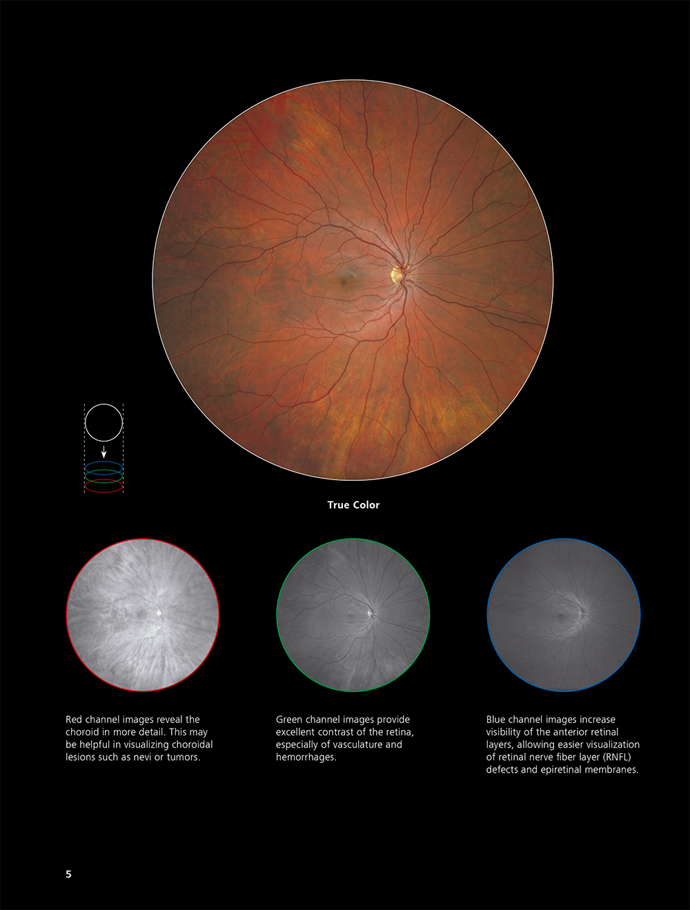 Zeiss Clarus 500 FA - Fundus Camera - Refurbished 12 clarus 500 6