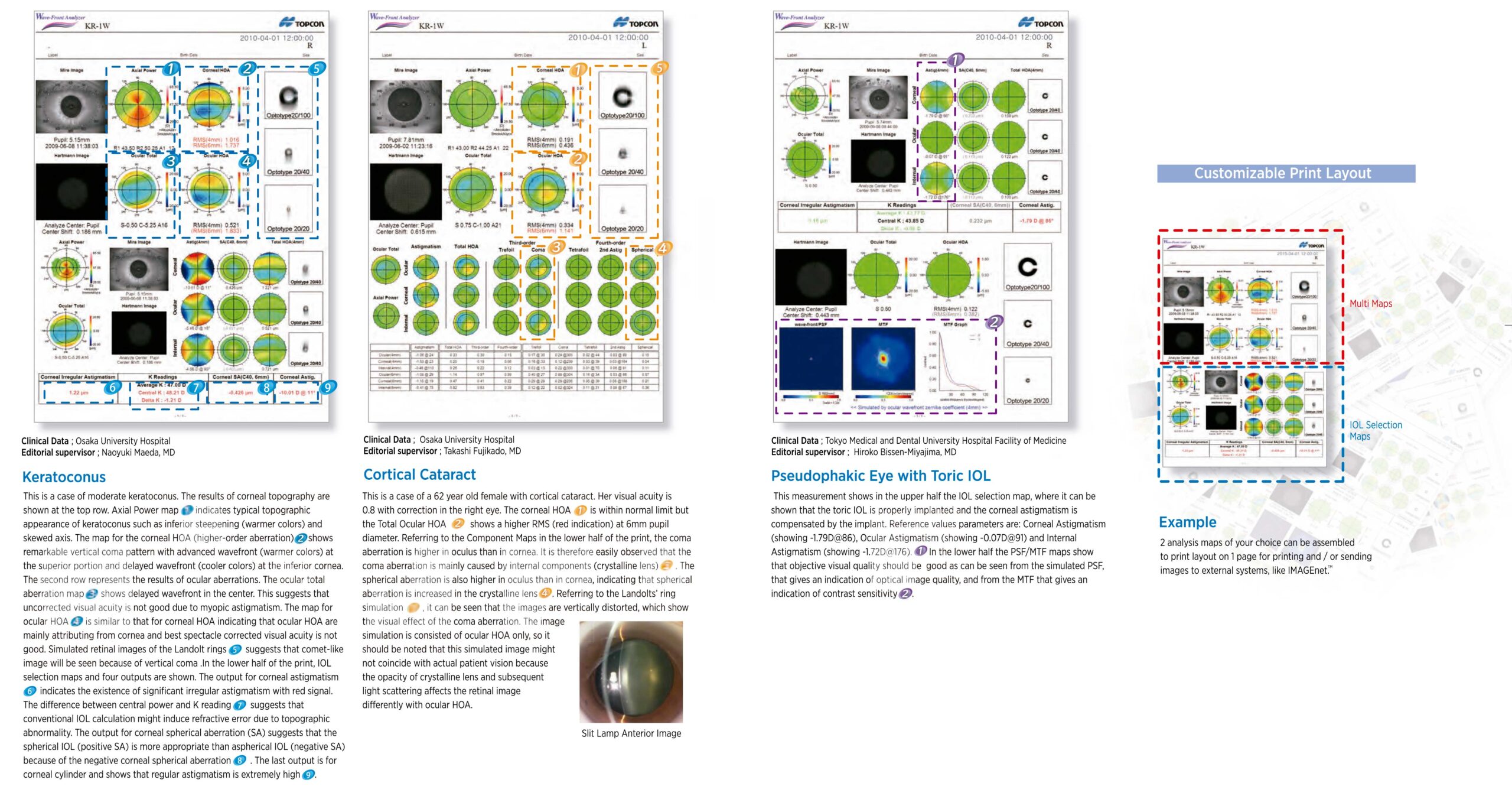 Topcon KR-1W - WaveFront Analyzer - Corneal Topographer - Used 14 Topcon KR-1W