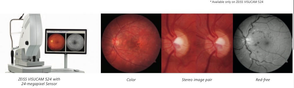 Zeiss Visucam - 524 - Fundus Camera - Refurbished 4 ojorojo