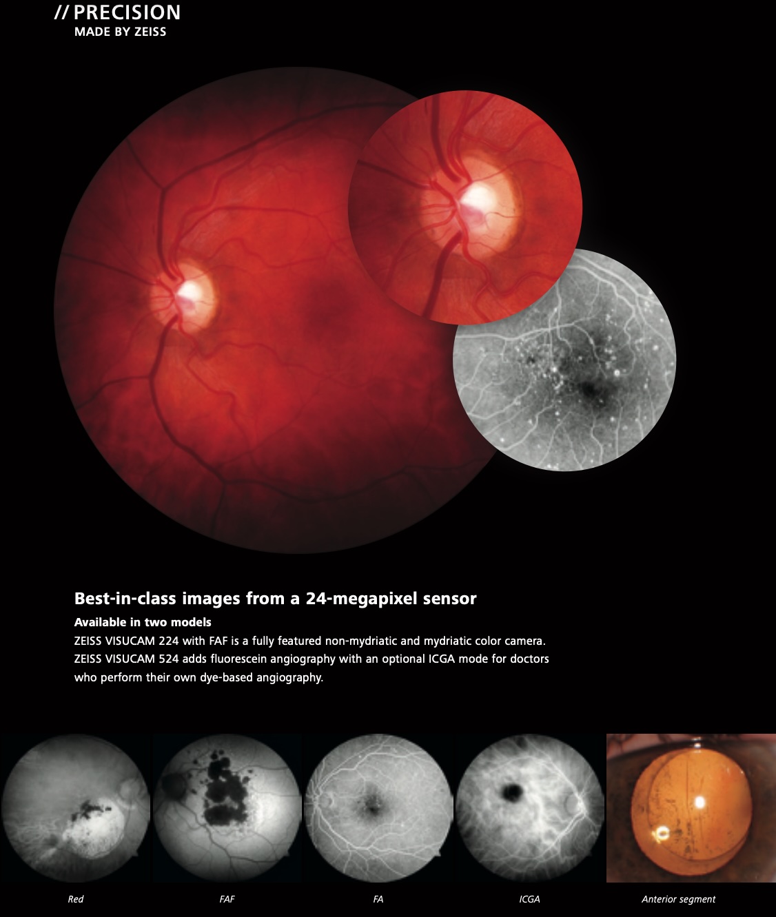 Zeiss Visucam - 524 - Fundus Camera - Refurbished 5 ojorojo3