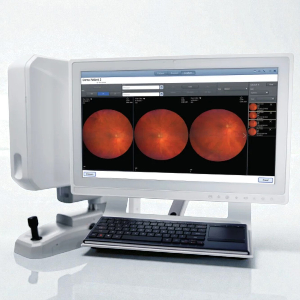 Zeiss Clarus 700 FA, FAF, ICG - Fundus Camera - Refurbished 1 Zeiss Clarus 700 FA, FAF, ICG - Fundus Camera - Refurbished