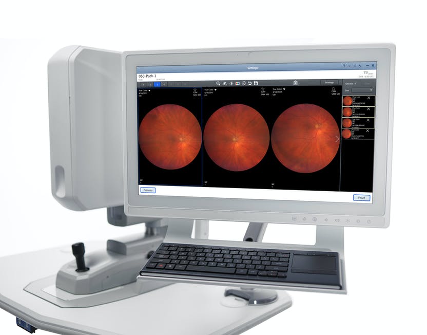 Zeiss Clarus 700 FA, FAF, ICG - Fundus Camera - Refurbished 3 Zeiss Clarus 700 FA, FAF, ICG - Fundus Camera - Refurbished - Image 3