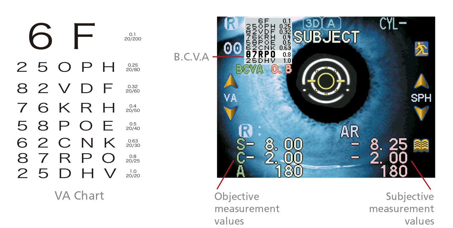 Nidek ARK-560A - Autorefractor Keratometer - Used 11 144670104911 Nidek ARK 560A Autorefractor Keratometer Brochure 3