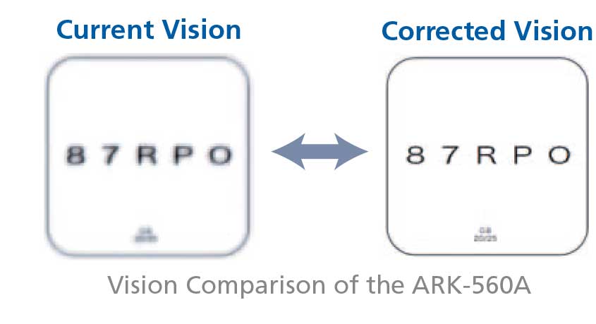 Nidek ARK-560A - Autorefractor Keratometer - Used 14 144670104911 Nidek ARK 560A Autorefractor Keratometer Brochure 4 1